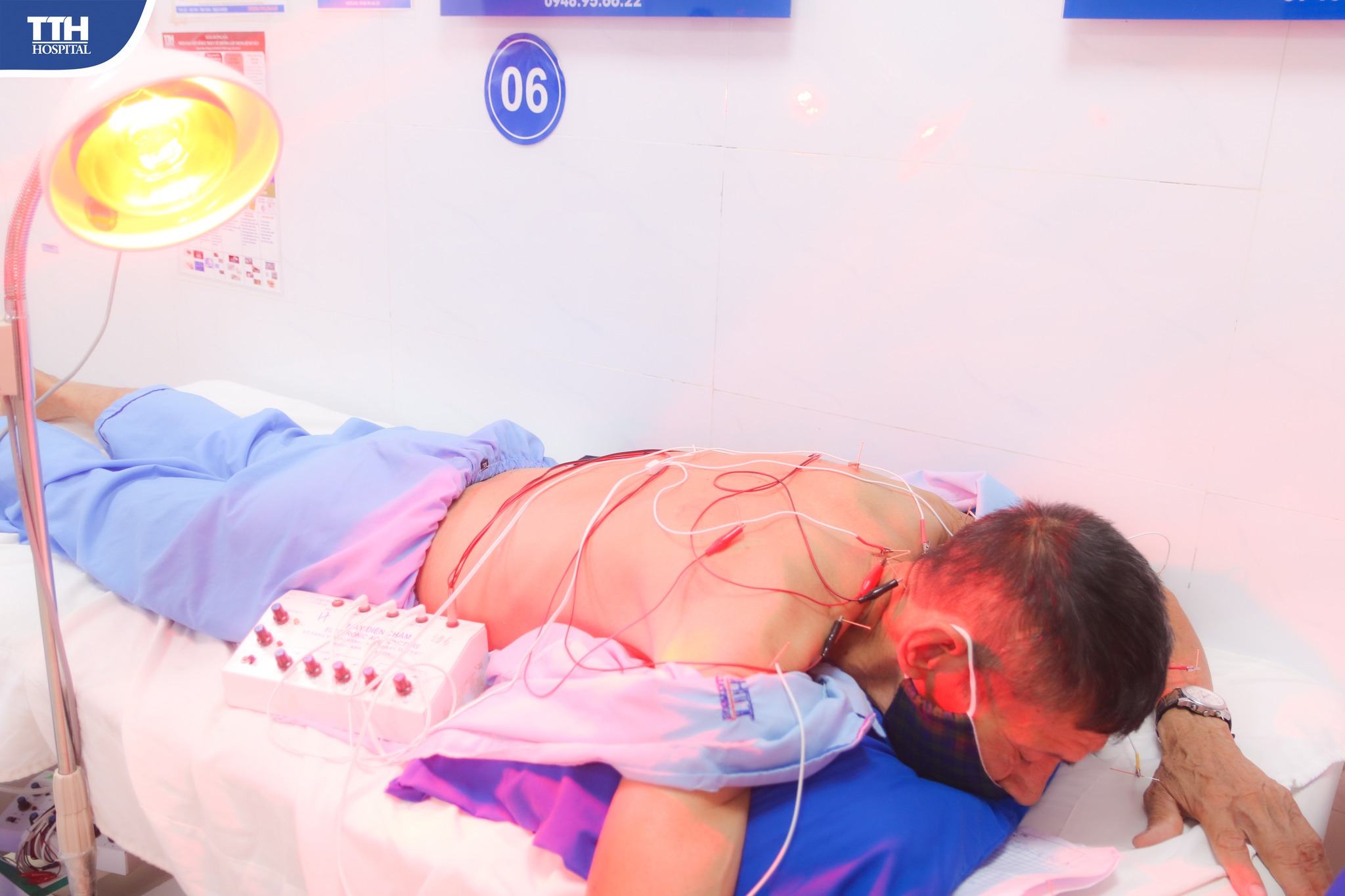 Phương pháp đông y điều trị đau thần kinh tọa